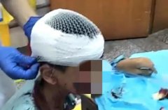 �к������Ȯ˺ҧ �ദ��ɼ��ǵ�˺�������˴�Ŀ����